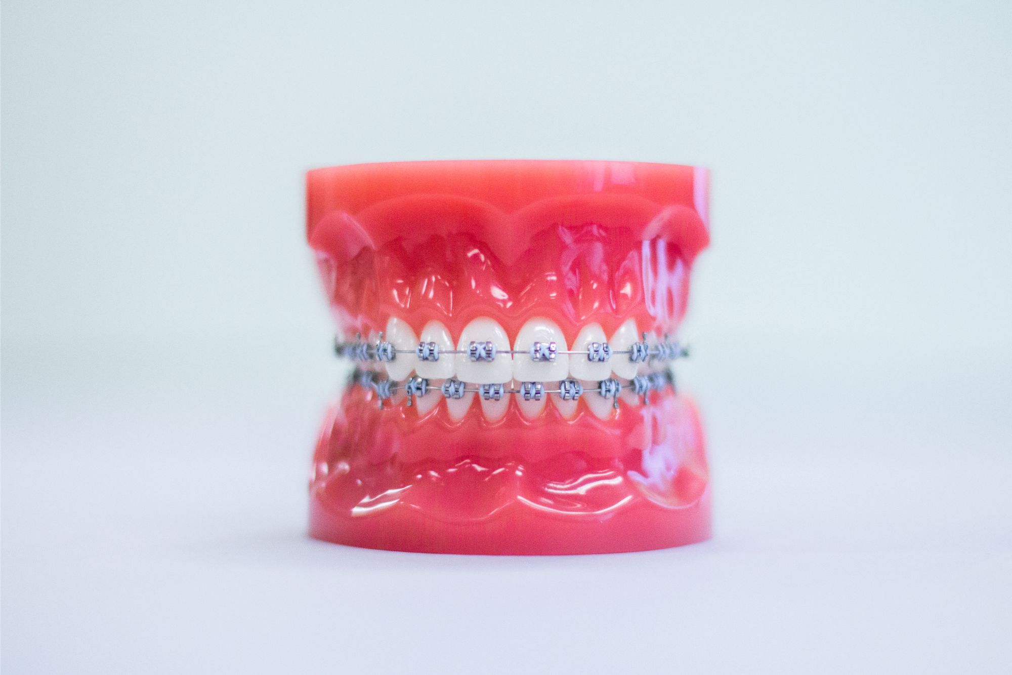 Keller Braces