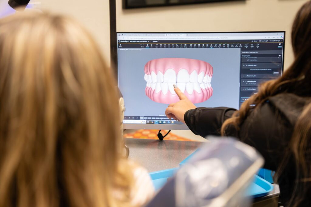 Oliv Aligners vs. Invisalign: Which Clear Aligner Is Right for You?